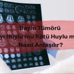 Beyin Tümörü: İyi Huylu mu Kötü Huylu mu? Nasıl Anlaşılır?