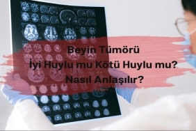 Beyin Tümörü: İyi Huylu mu Kötü Huylu mu? Nasıl Anlaşılır?