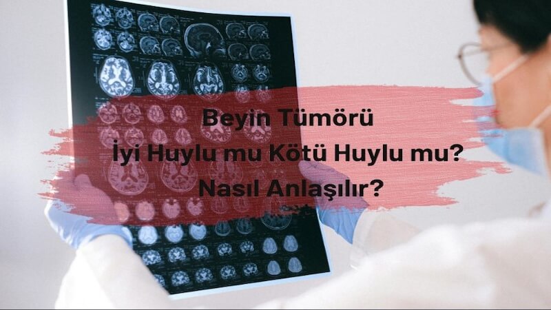 Beyin Tümörü: İyi Huylu mu Kötü Huylu mu? Nasıl Anlaşılır?